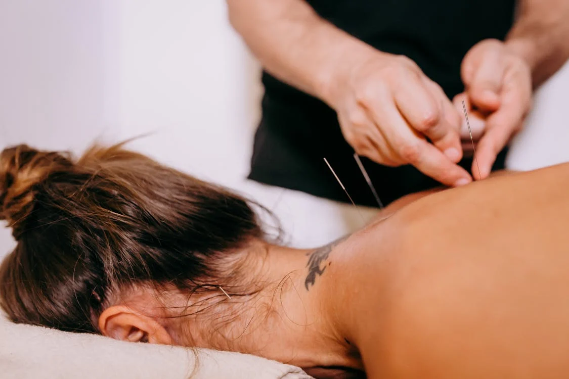 Quel acupuncteur trouver pour arreter de stresser ?